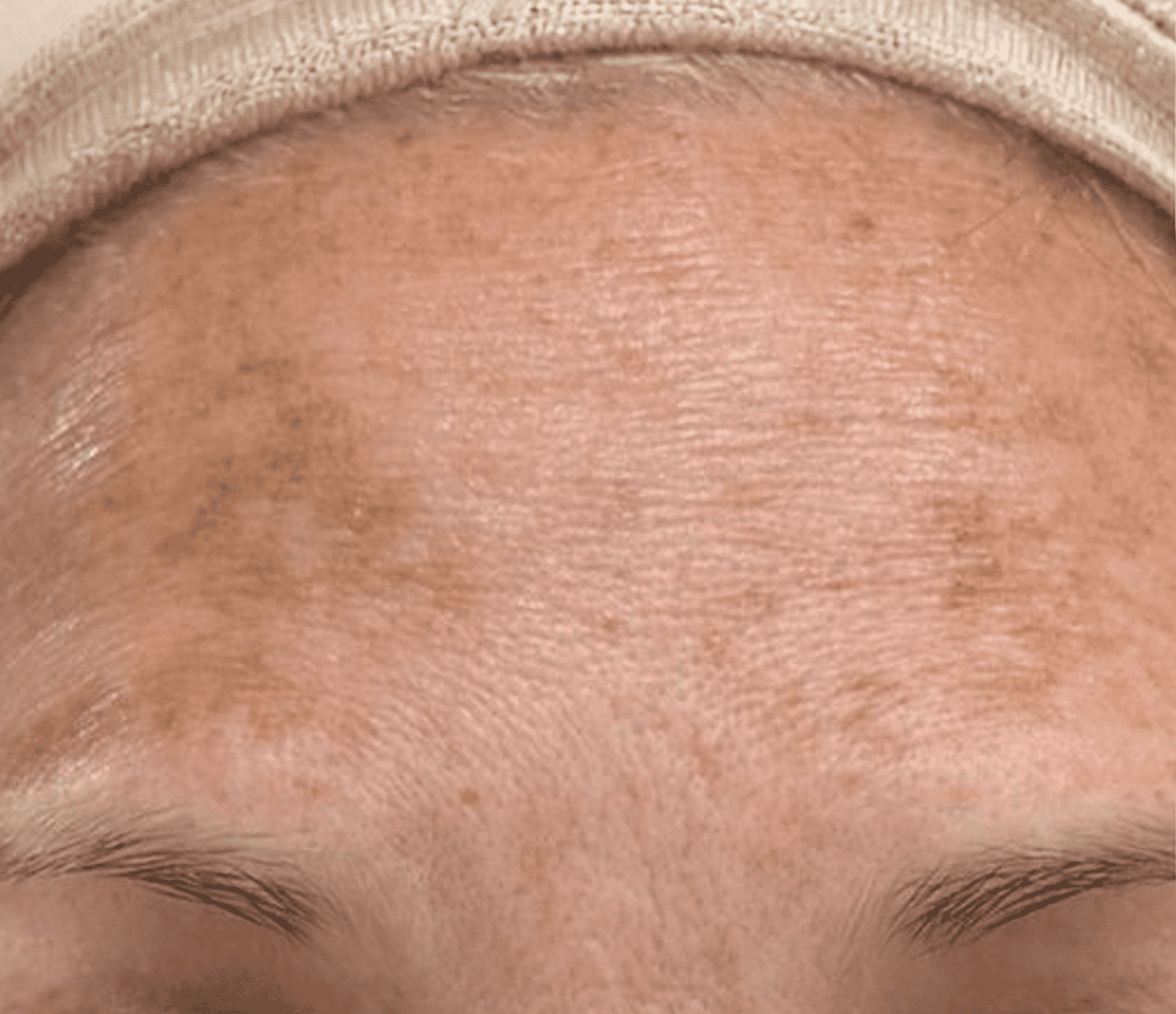 Before result image