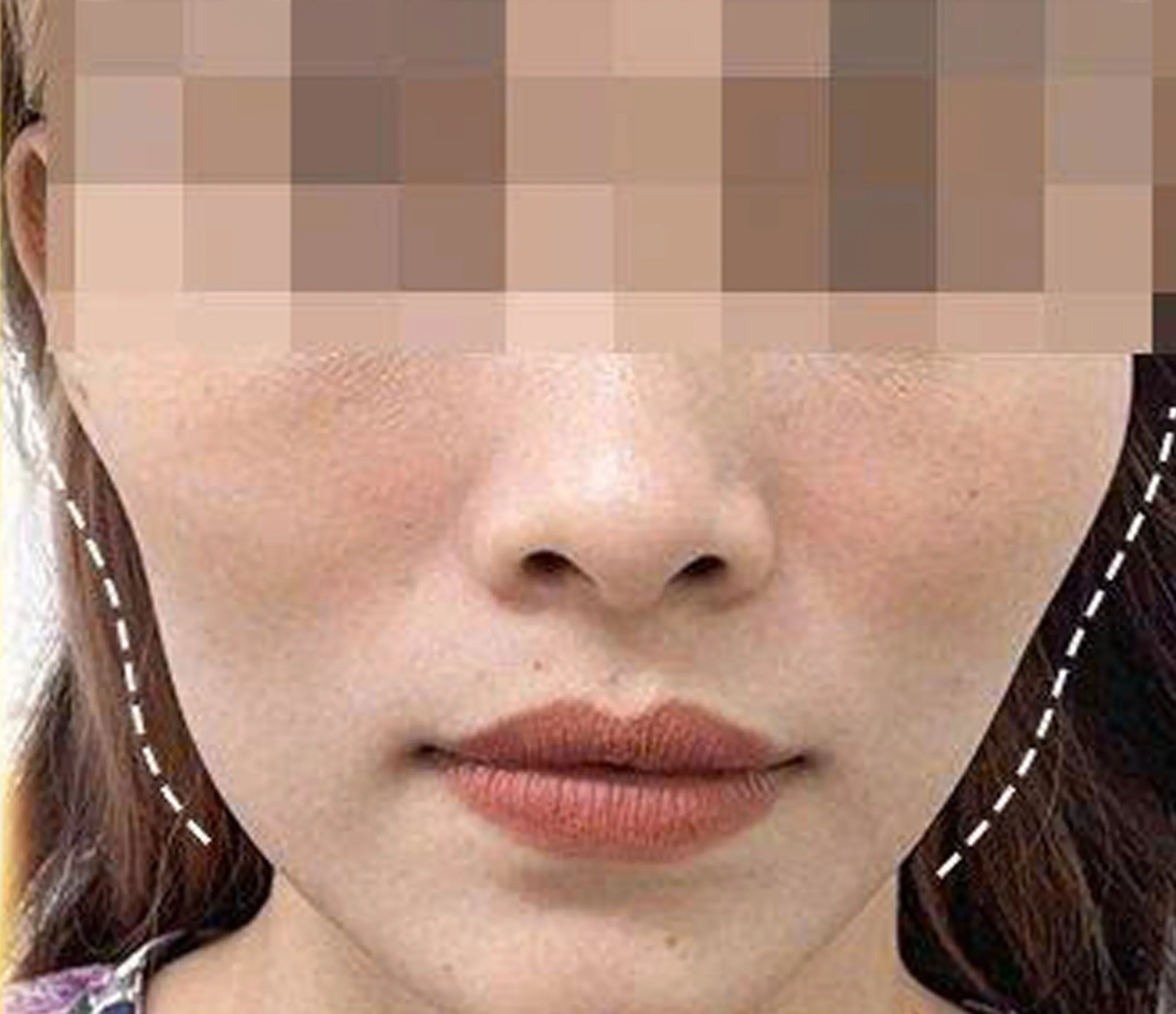 Before result image