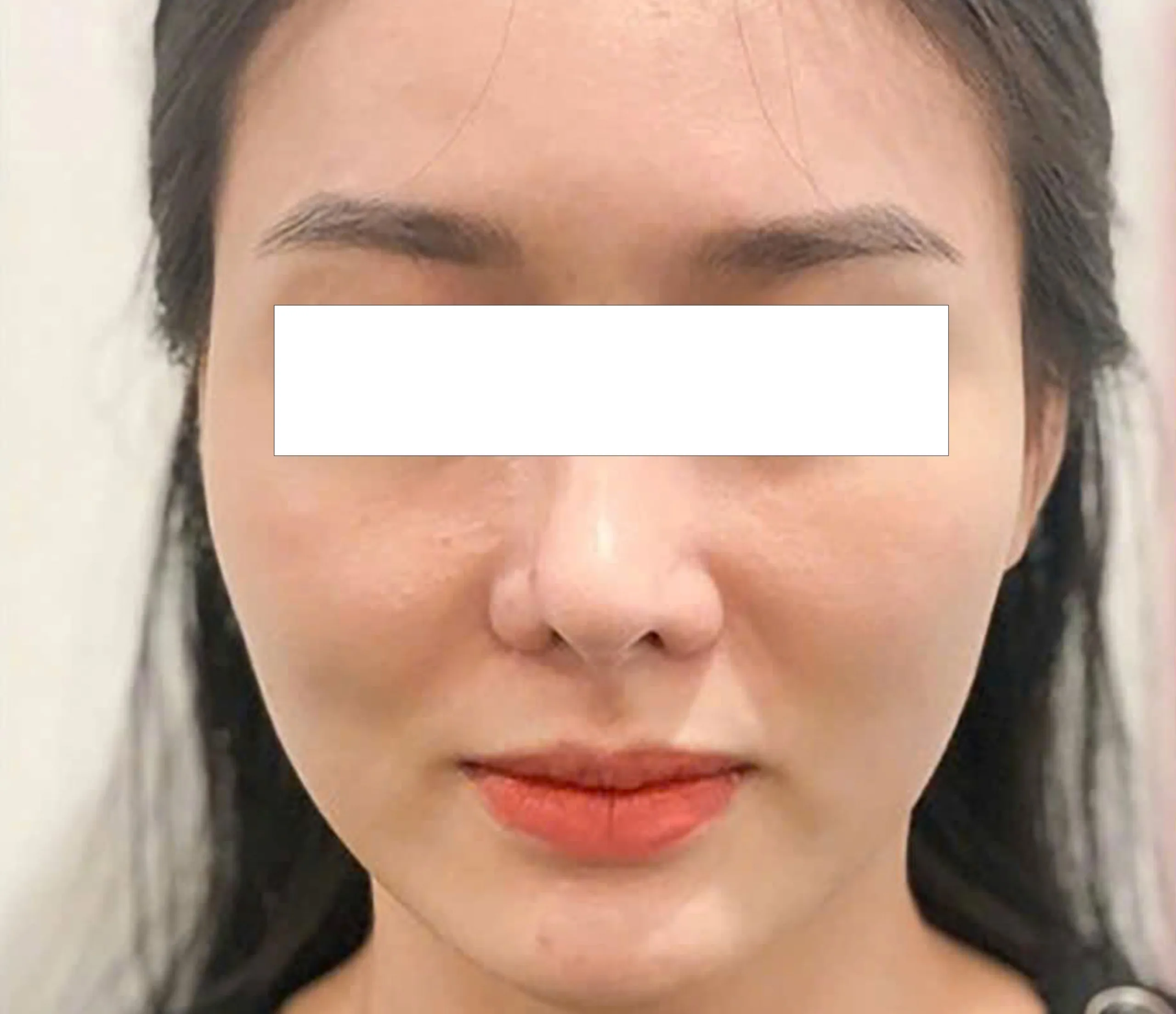 Before result image