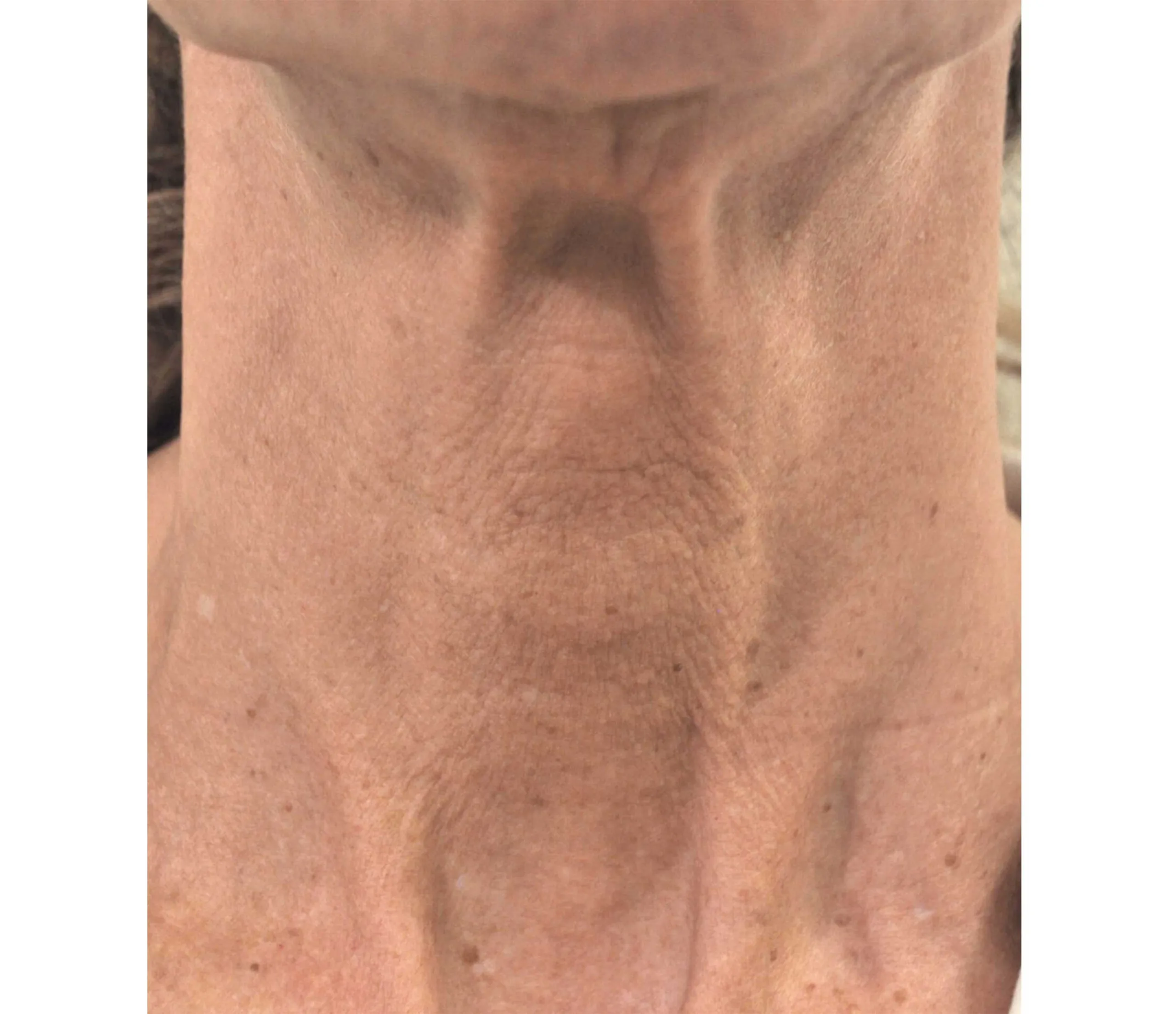 Before result image