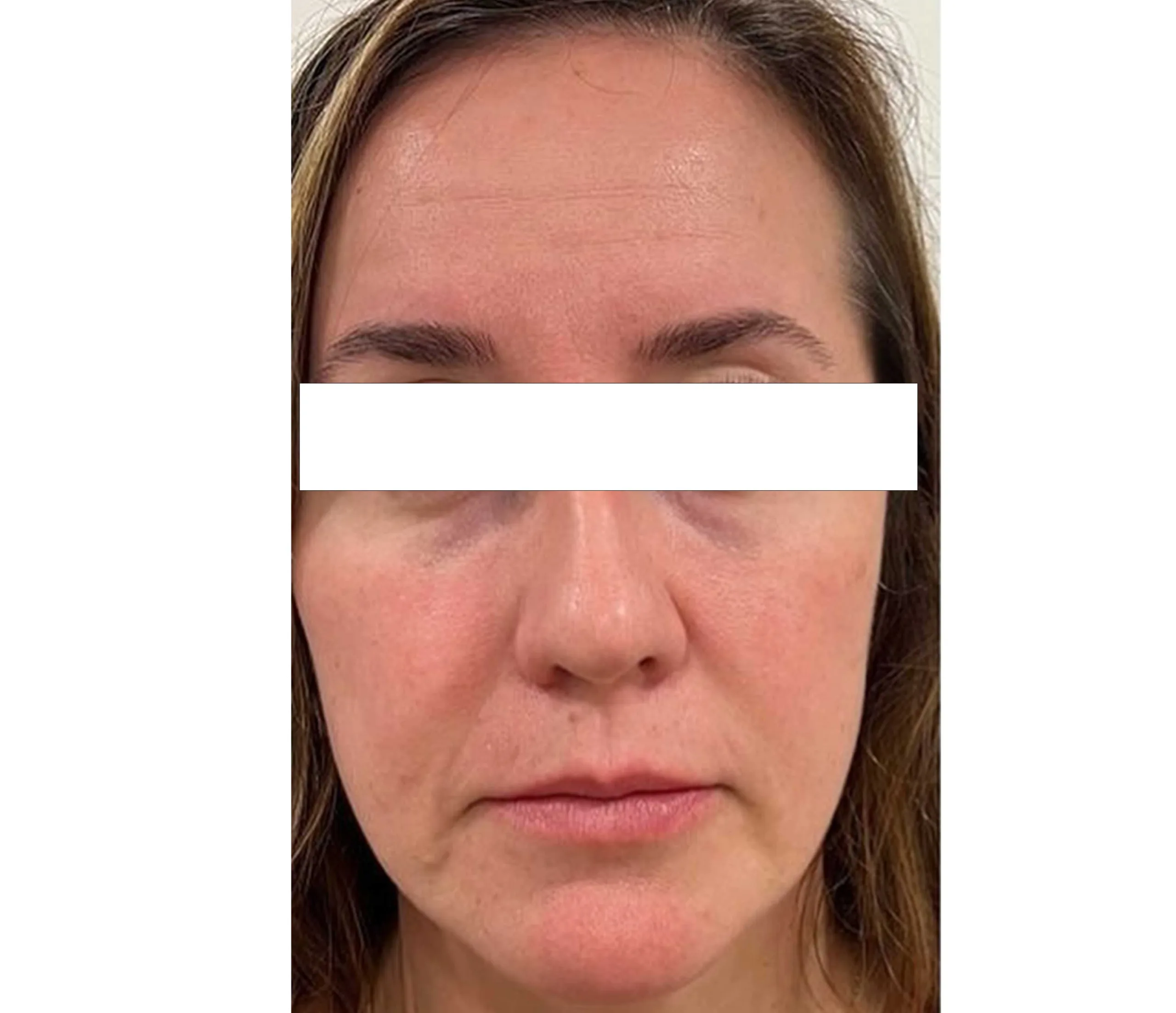 Before result image