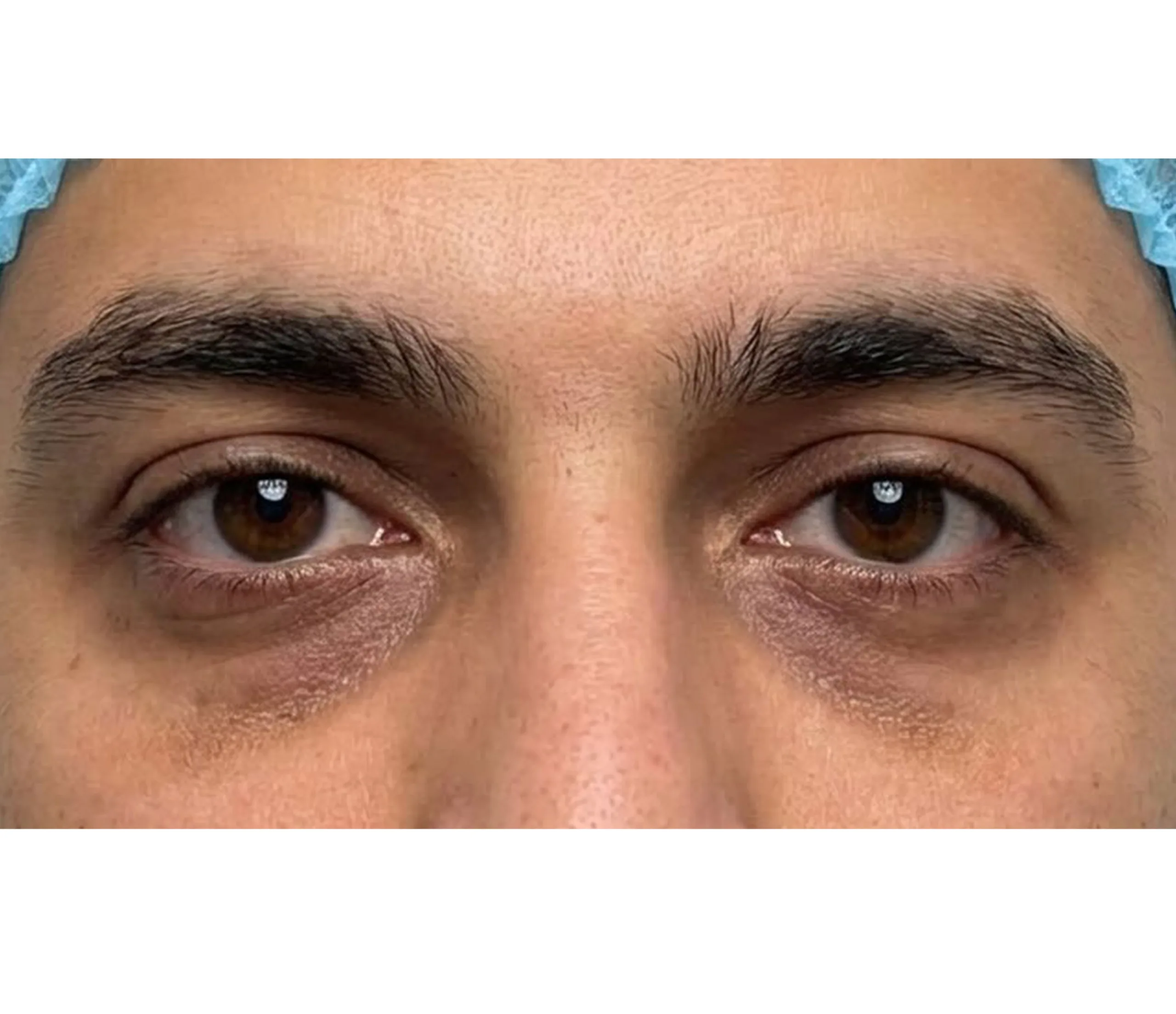 Before result image